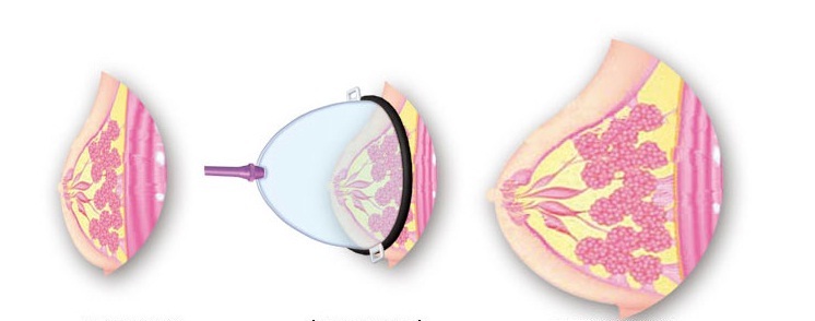 đồ chơi tình dục kích thích ngực